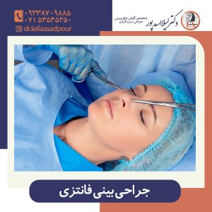 جراحی بینی فانتزی - دکتر اسدپور